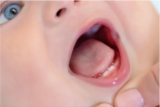 The First Dental Visit: Setting the Stage for Healthy Smiles and Growth